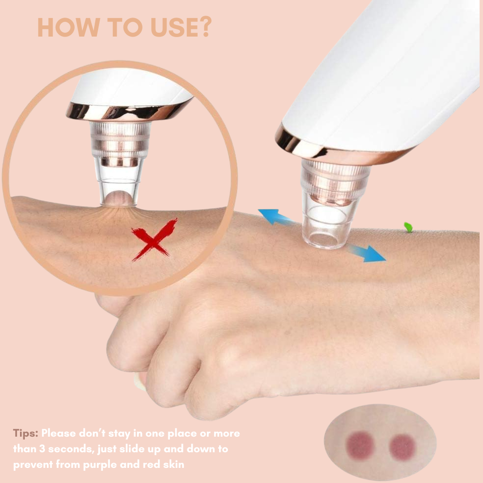Blackhead Remover Rechargeable Suction & Interchangeable Heads