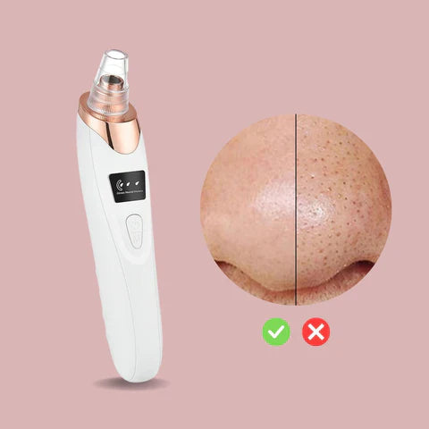 Blackhead Remover Rechargeable Suction & Interchangeable Heads
