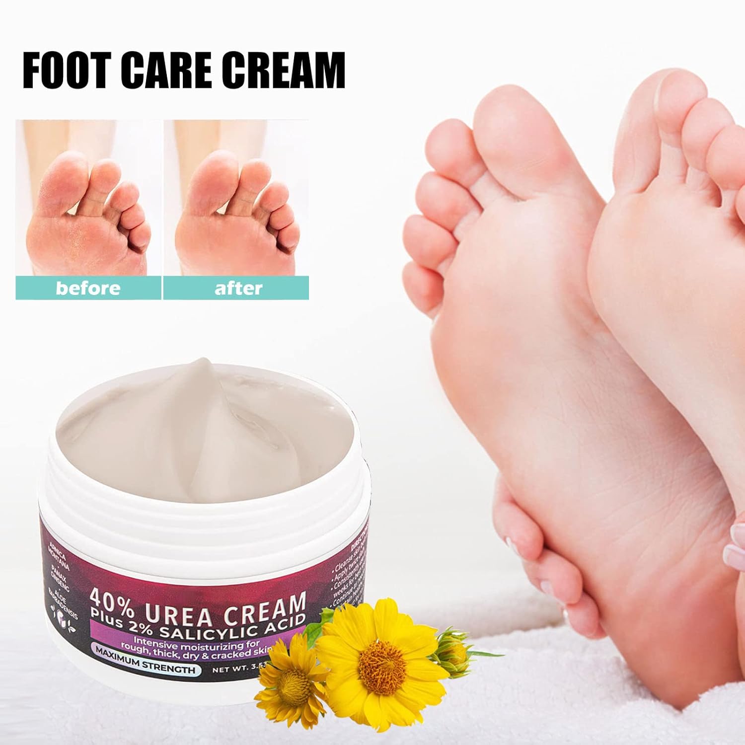 Callus Remover Cream Salicylic Acid & Plant Oils