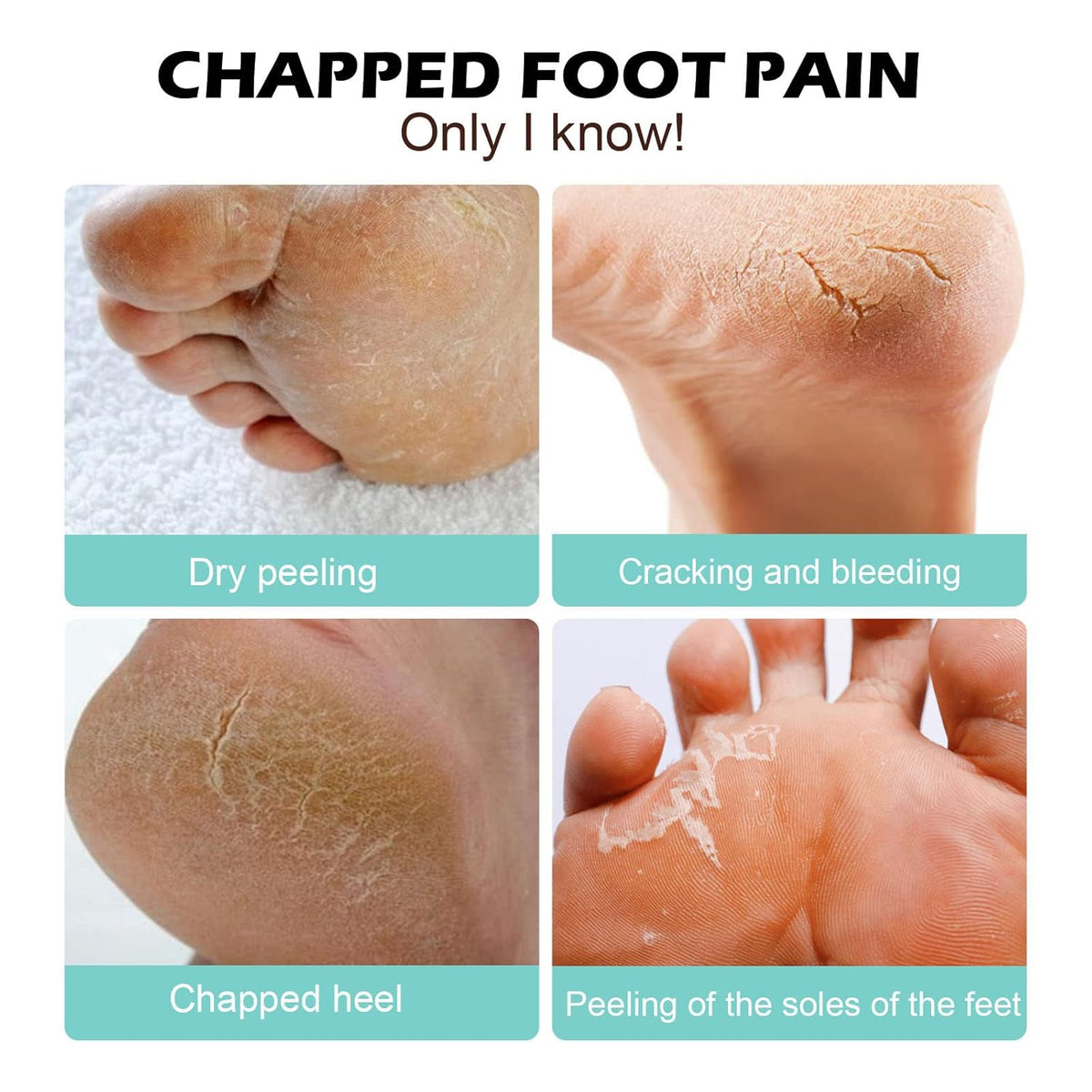 Callus Remover Cream Salicylic Acid & Plant Oils