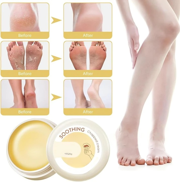 Cracked Heel Repair Balm Instant Hydration All Day Protection