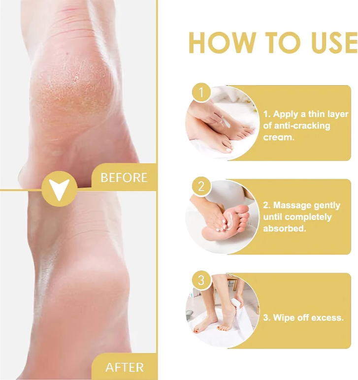 Cracked Heel Repair Balm Instant Hydration All Day Protection