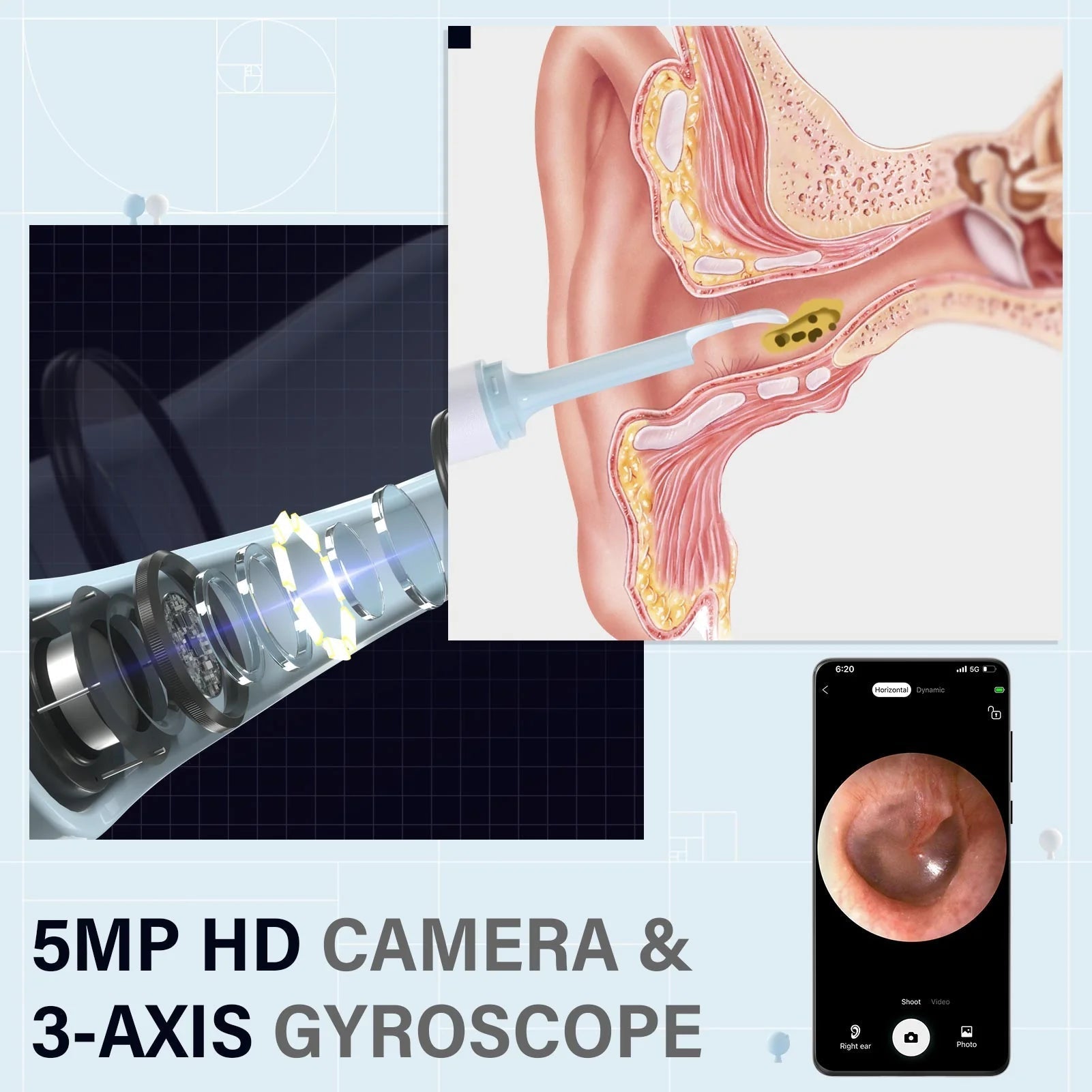 Earwax Removal Kit HD Camera & Silicone Tips