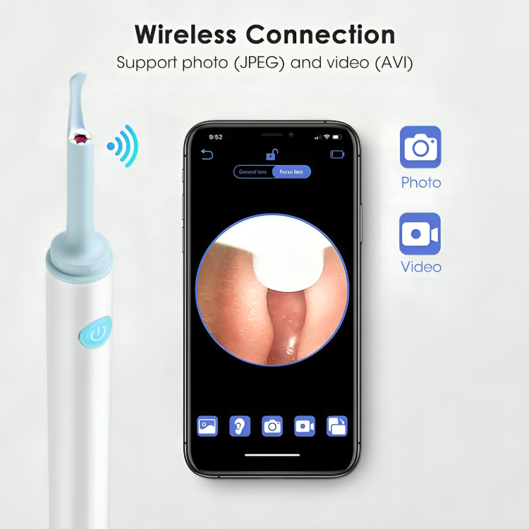 Earwax Removal Kit HD Camera & Silicone Tips