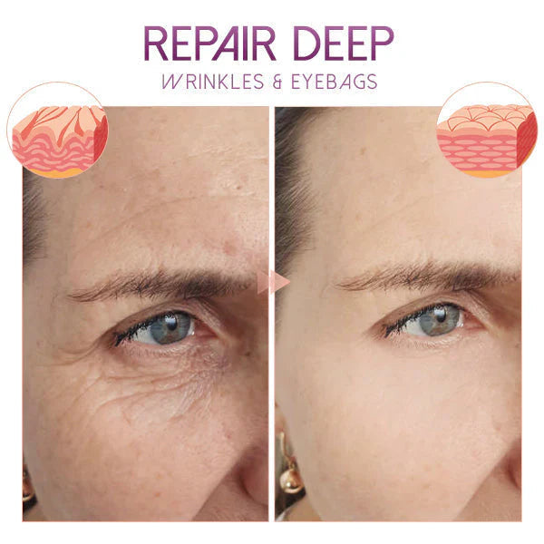 Eye Cream Anti-Aging Lifting Hyaluronic Acid & Venom Essence