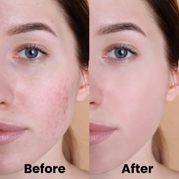 Facial Brightening Pads Turmeric & Kojic Acid