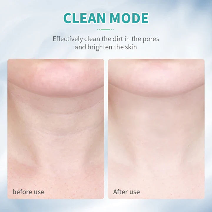 Facial & Neck Sculpting Device Microcurrent & LED
