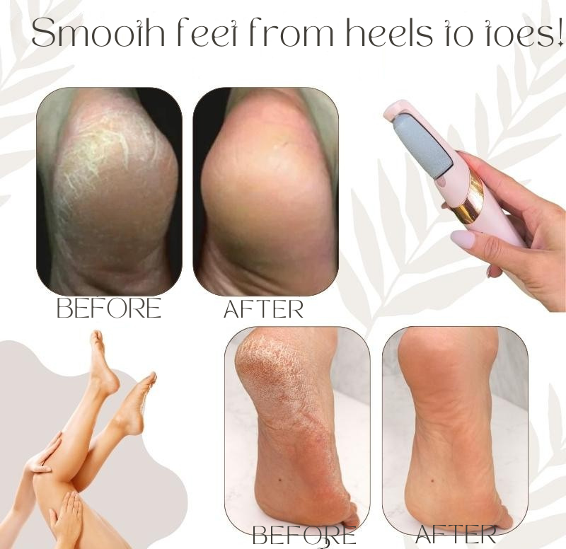 Foot Callus Remover Quartz Rollers Rechargeable Dual Heads