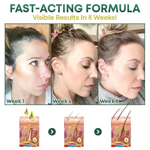 Hair Growth Spray Ginger & Ginseng Non-Greasy