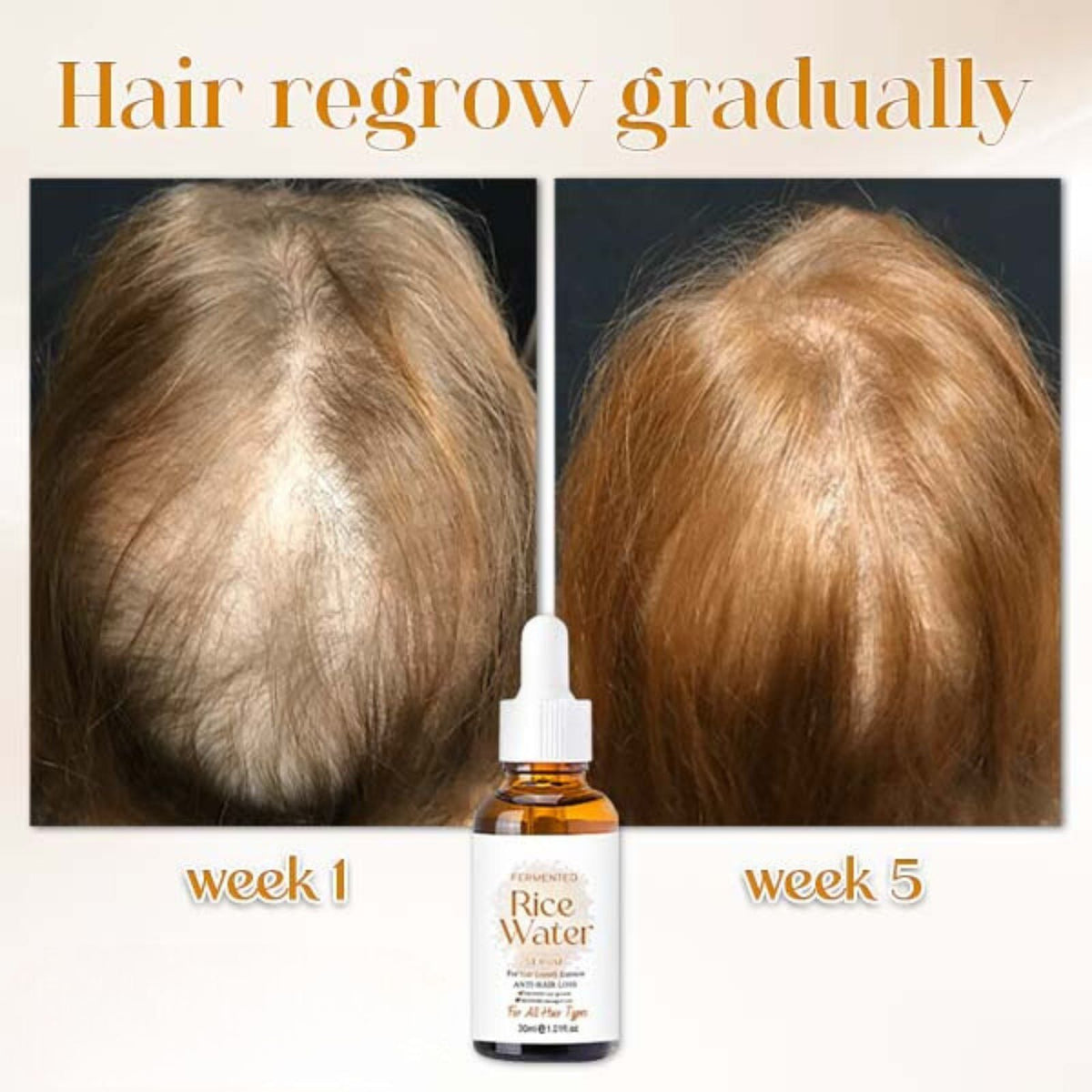 Hair Serum Fermented Rice Water Reduces Hair Loss