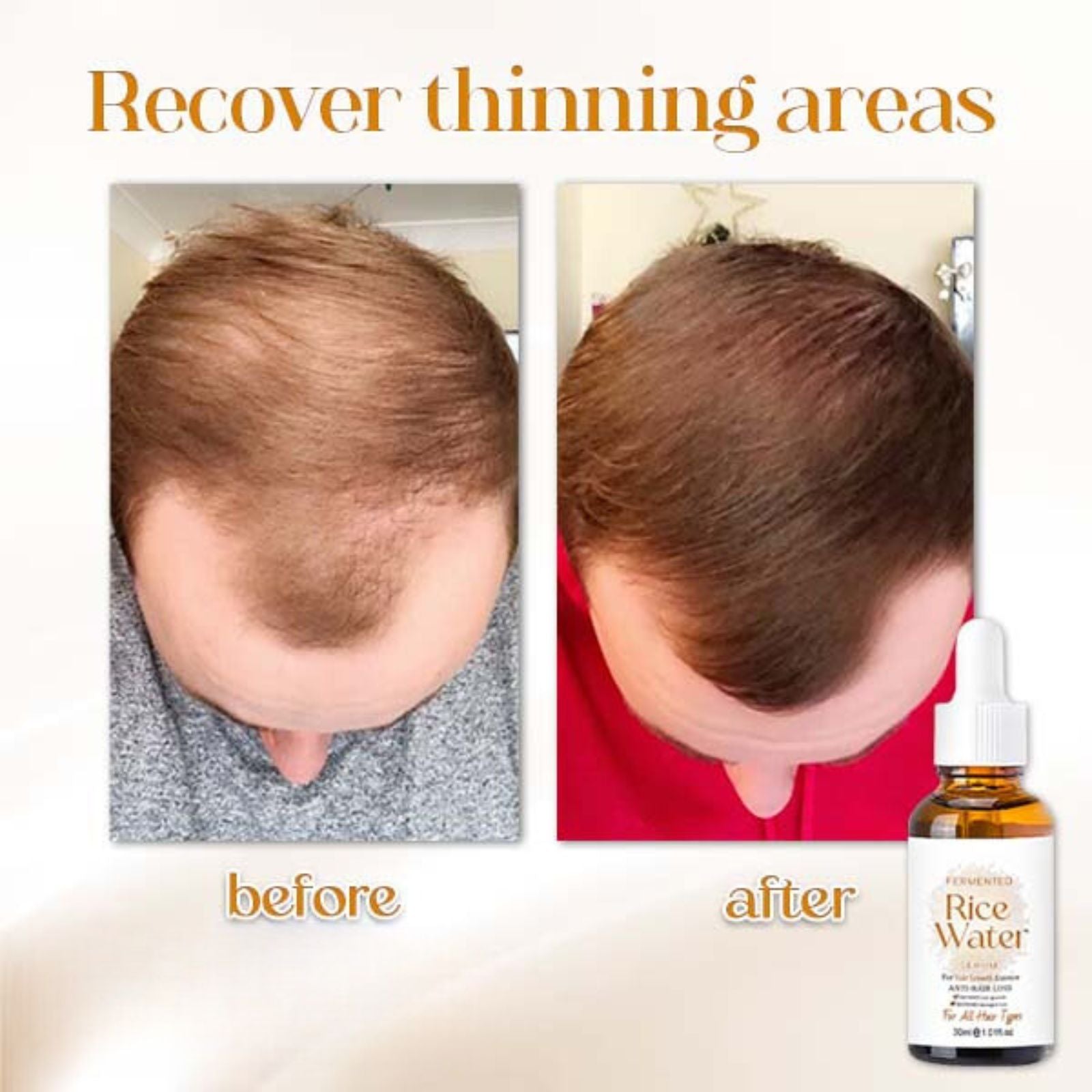 Hair Serum Fermented Rice Water Reduces Hair Loss