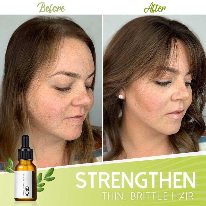 Hair Serum Growth-Activating Natural Extracts Set of 2