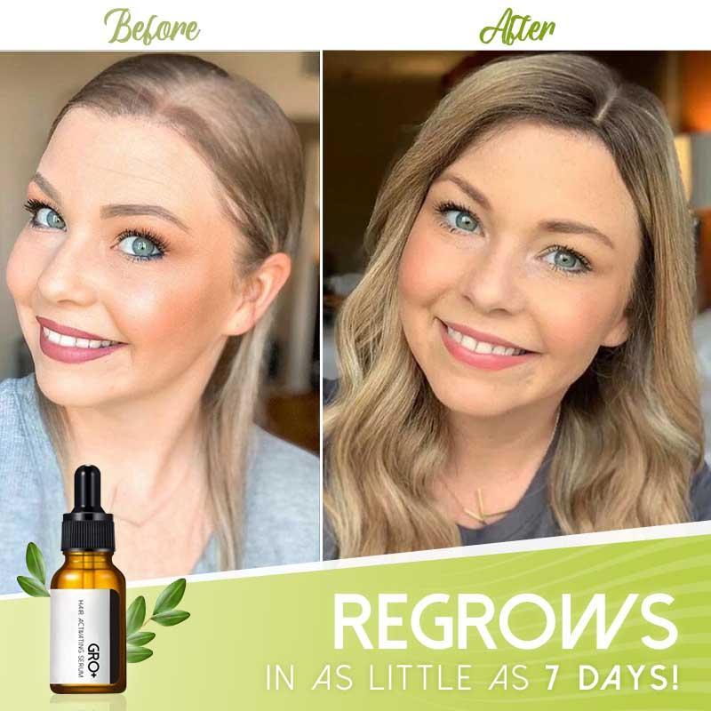 Hair Serum Growth-Activating Natural Extracts Set of 2
