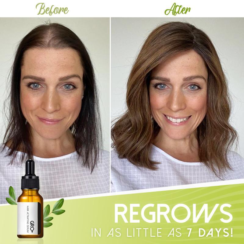 Hair Serum Growth-Activating Natural Extracts Set of 2