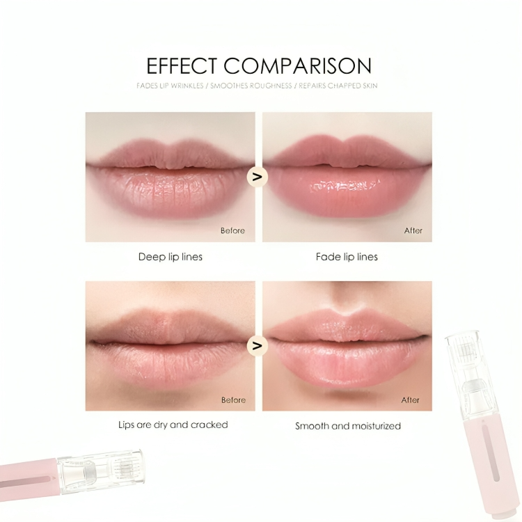 Lip Plumping Roller Microneedle Stainless Steel Tips