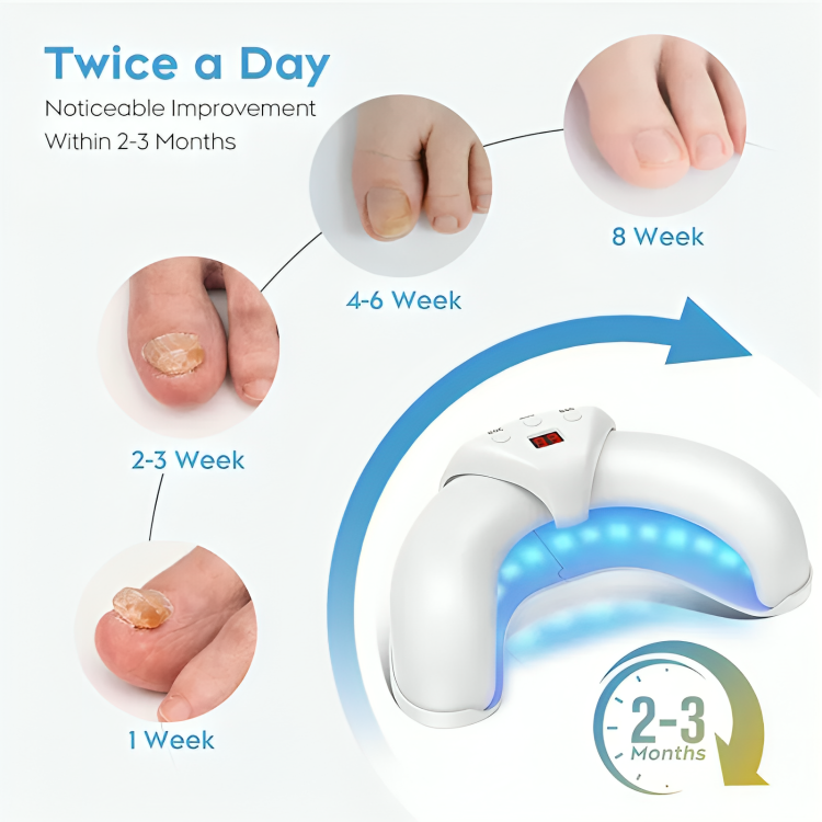 Nail Fungus Treatment Device Targeted Laser USB Rechargeable
