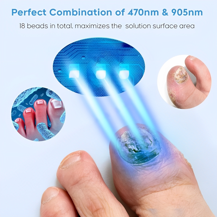 Nail Fungus Treatment Device Targeted Laser USB Rechargeable