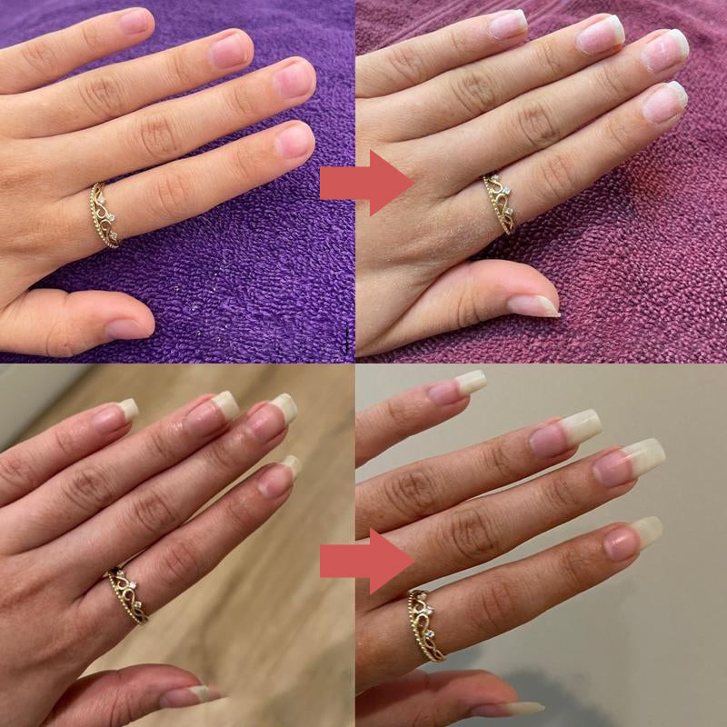 Nail Growth Oil Strengthening & Nourishing 5ml