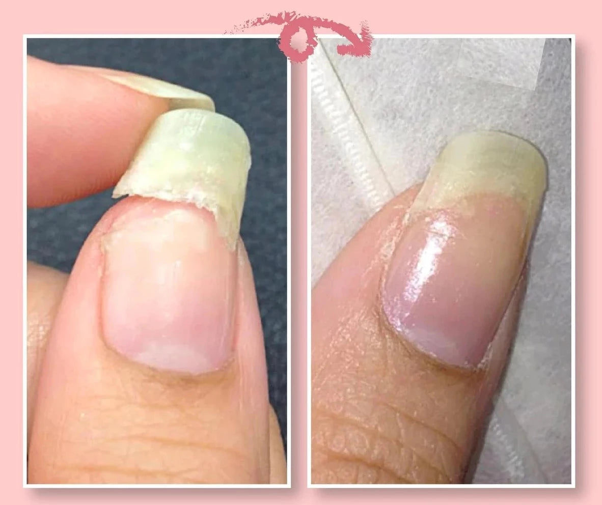 Nail Repair Gel Instant Clear Long-Lasting