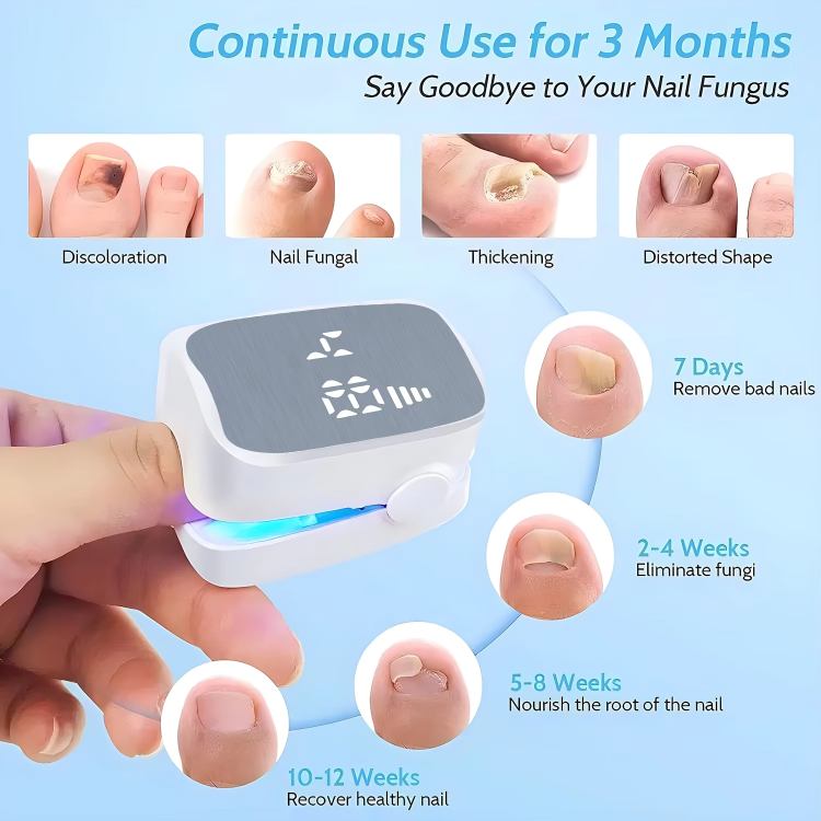 Nail Treatment Antifungal Fast-Acting 7-Min Daily