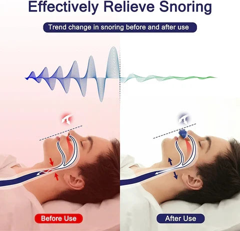 Nasal Cannula Mask-Free USB Rechargeable