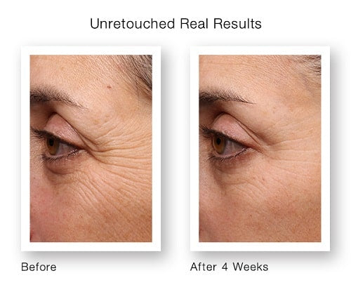 Retinol Serum Anti-Aging Hydrating For Sensitive Skin