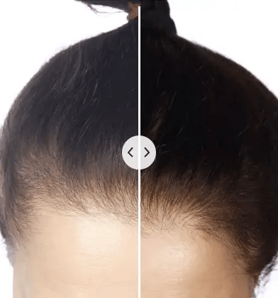 Scalp Massager Dual Red & Blue Light 3 Modes