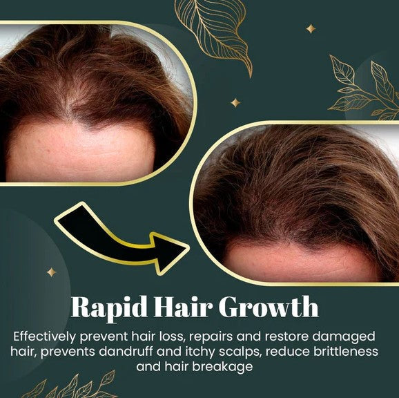 Scalp Scrub Gentle Exfoliating Plant Extracts & Vitamins