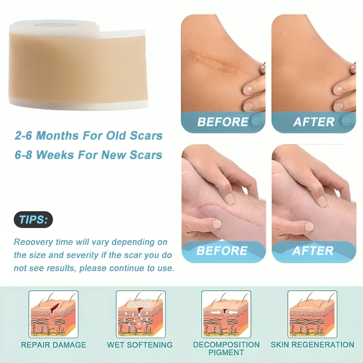 Scar Sheets Silicone Gel Hydrating Set of 2