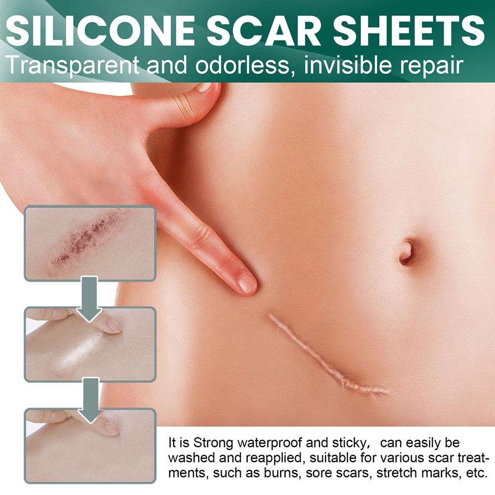 Scar Sheets Silicone Gel Hydrating Set of 2