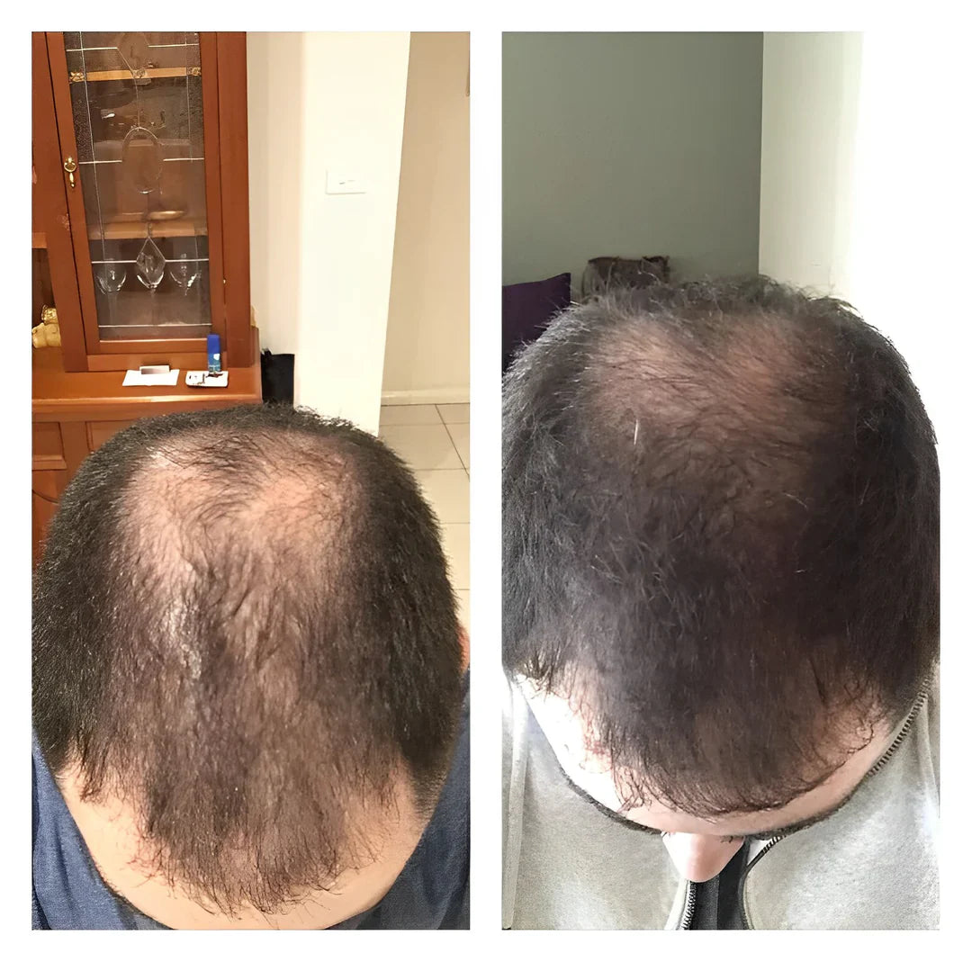 Shampoo Bar Fermented Rice Water Hair Growth