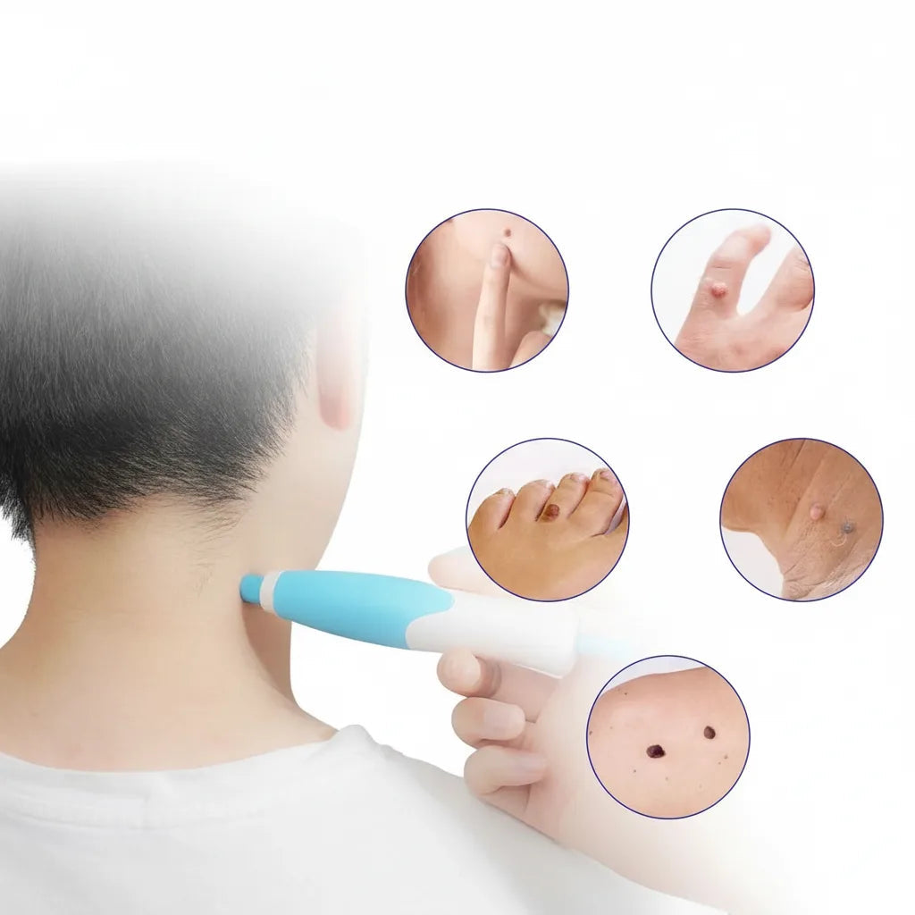 Skin Spot Removal Kit Painless Applicator Silicone Bands