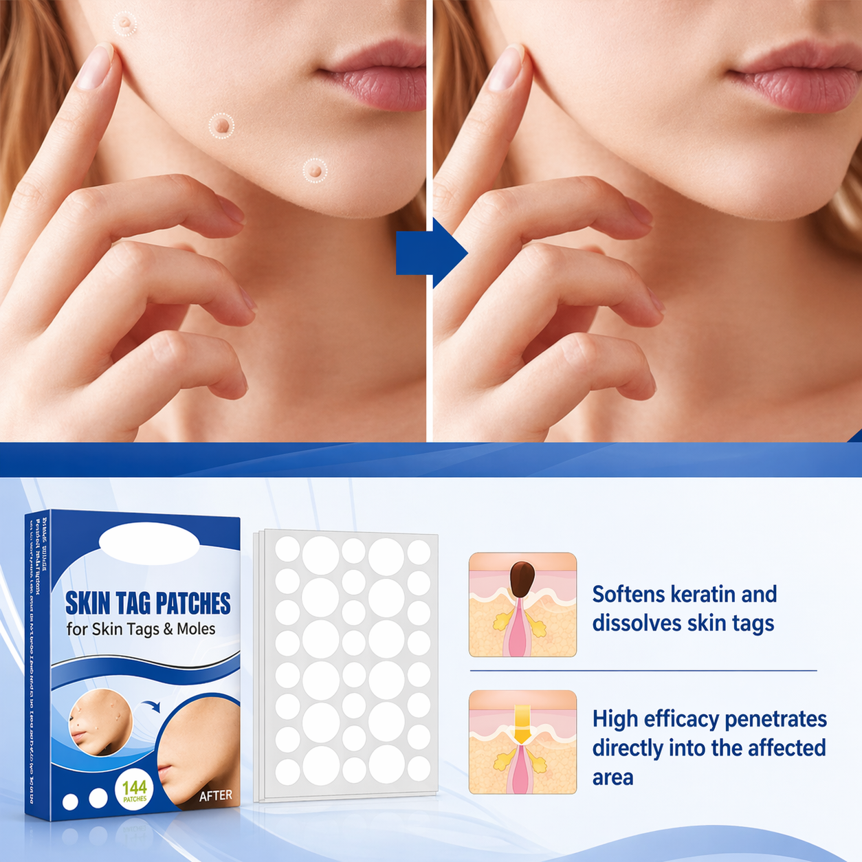 Skin Tag Removal Patches Ultra-Thin Transparent 144 Pack