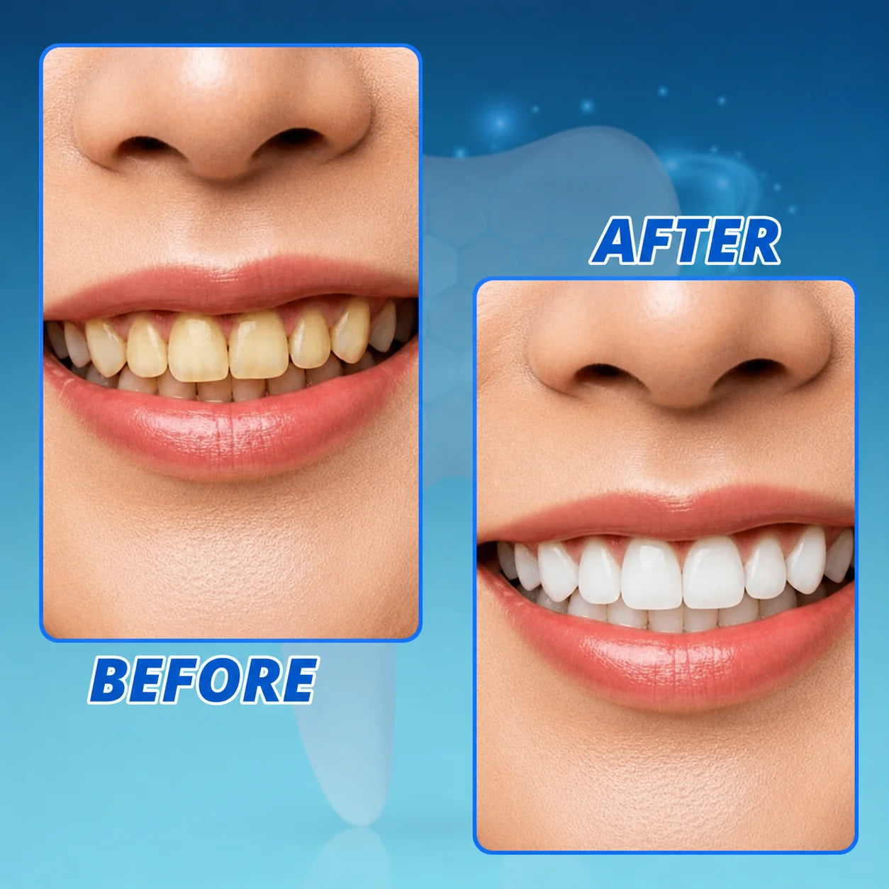 Teeth Whitening Pen Gentle Peroxide Precision Brush