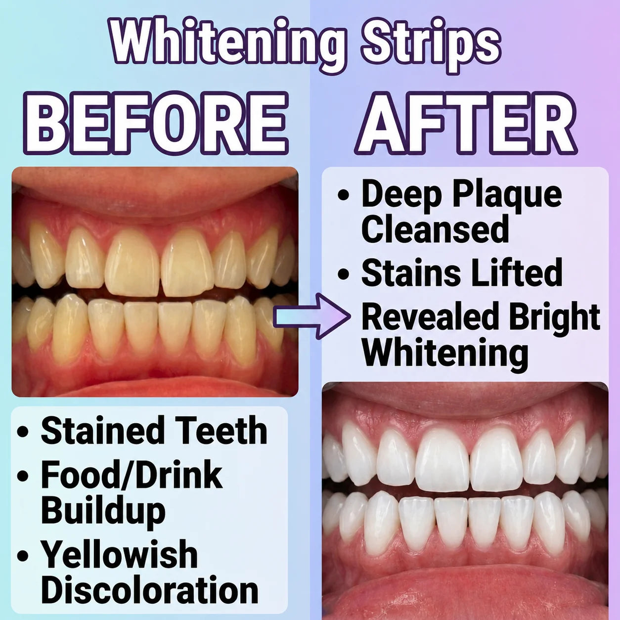 Teeth Whitening Strips Flexible Fit 30-Minute Pack of 14