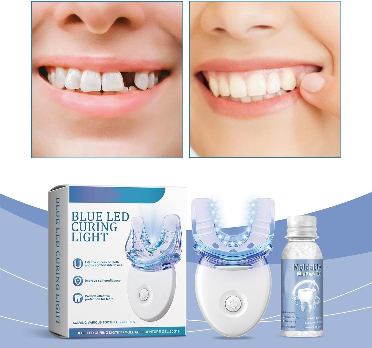 Tooth Repair Kit Moldable Gel & LED Curing