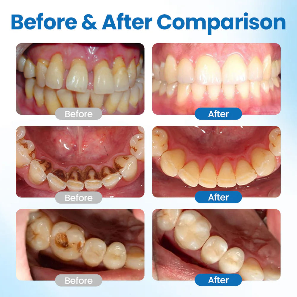Tooth Serum Remineralizing Nano-HAP Sensitivity Relief