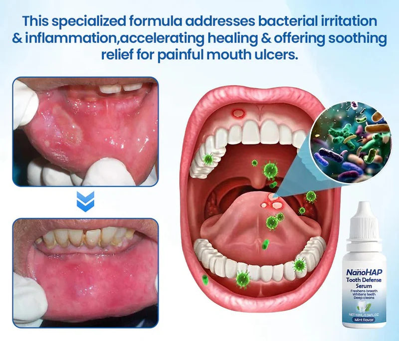 Tooth Serum Remineralizing Nano-HAP Sensitivity Relief