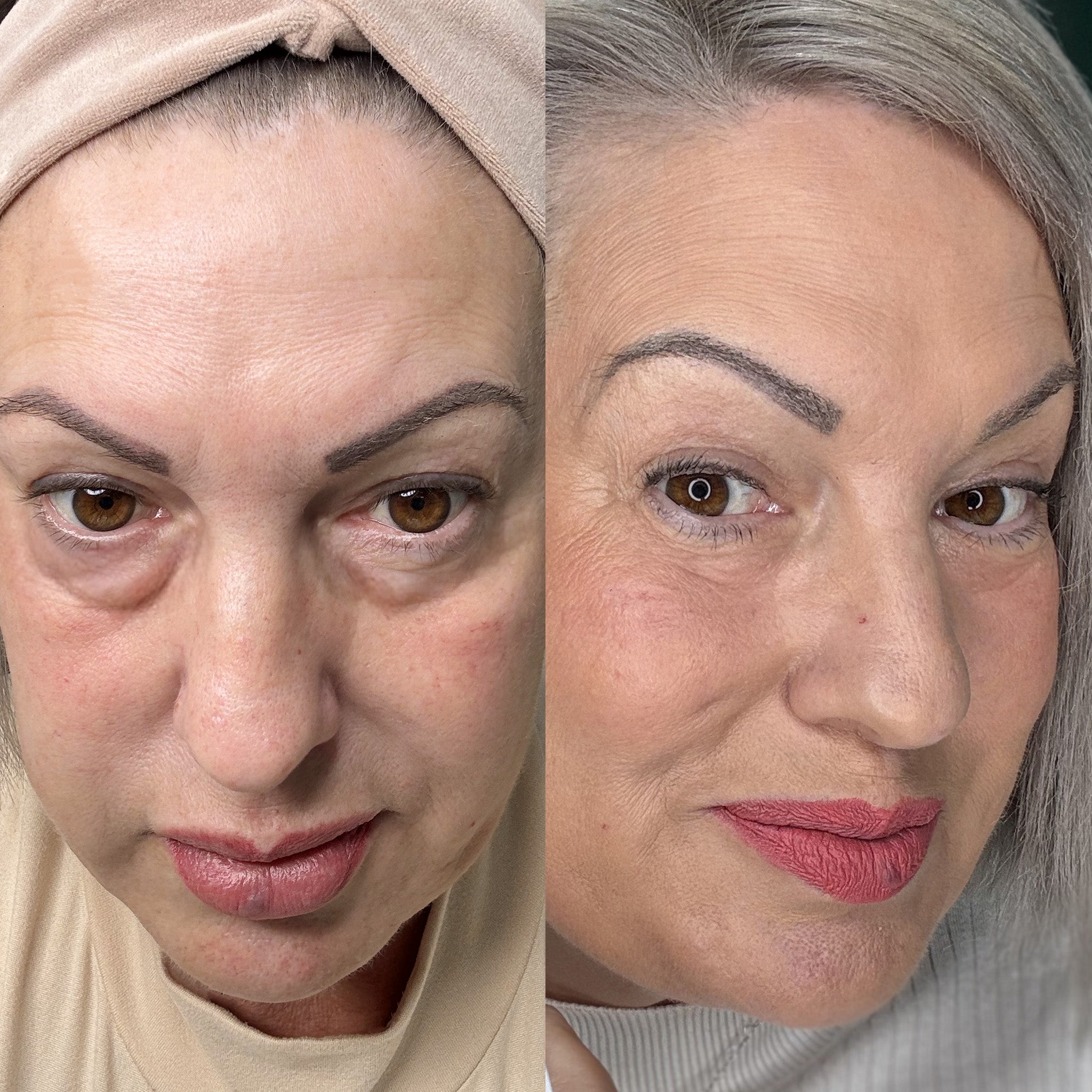 Under-Eye Device Red Light & Microcurrent Brightens & Firms