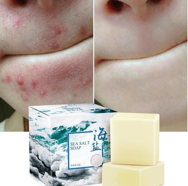 Revitalizing Sea Mineral Cleanser for Acne-Prone Skin