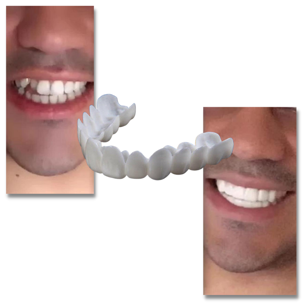 Transform Your Smile with Comfortable, Reusable Aligners