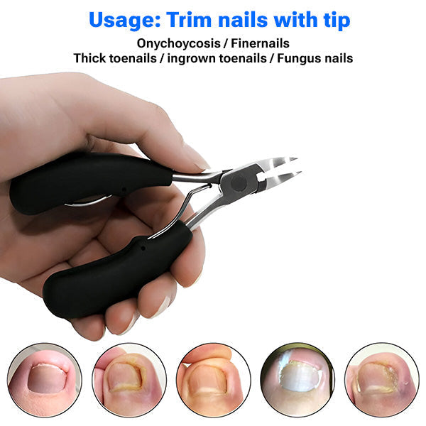 Essential Nail Grooming Set with Travel-Friendly Case