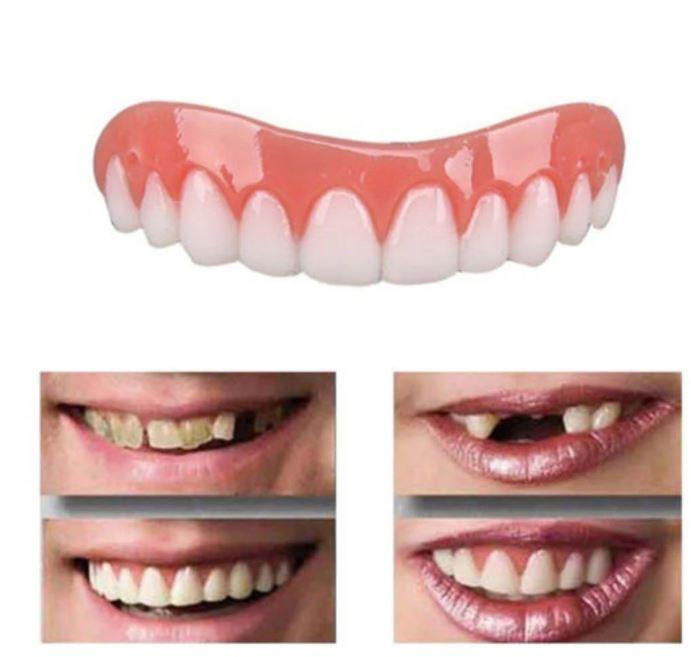 Custom Fit Dental Cover for a Confident Smile