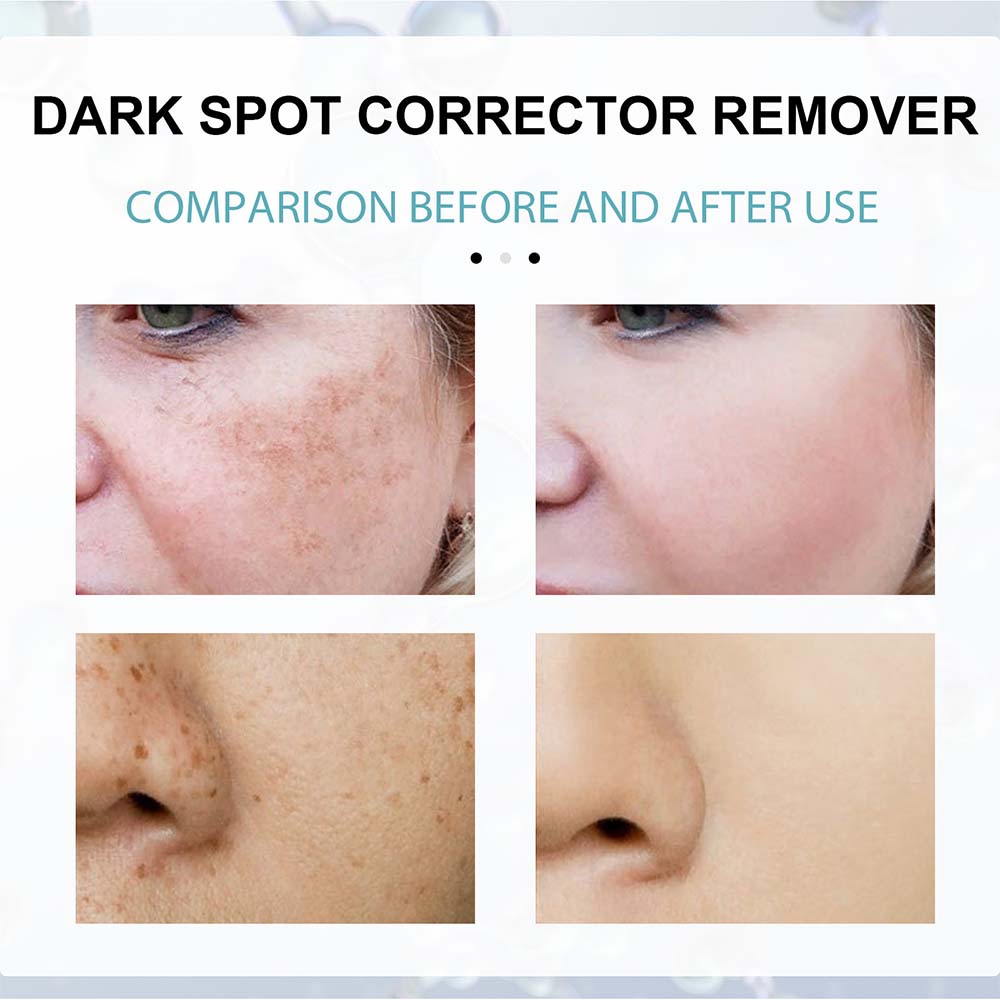 Brightening Cream for Even Skin Tone and Radiance