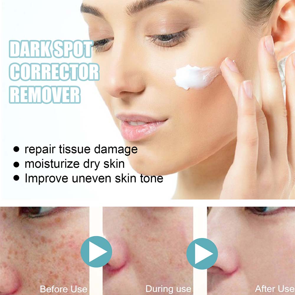 Brightening Cream for Even Skin Tone and Radiance