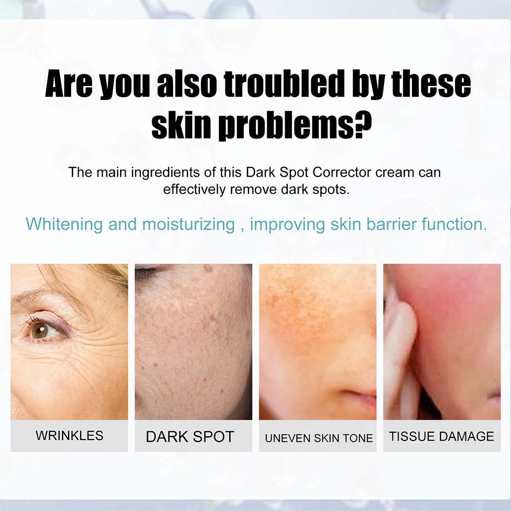 Brightening Cream for Even Skin Tone and Radiance