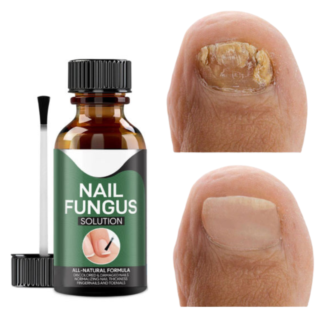 Nail Revival Essence: Banish Fungal Woes