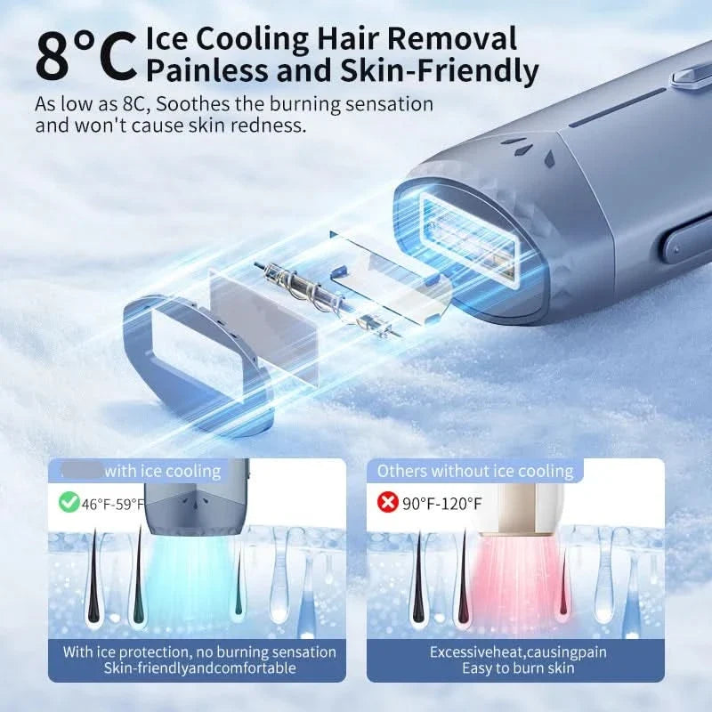 ChillGlow - Effortless Hair Removal Device for Home Comfort