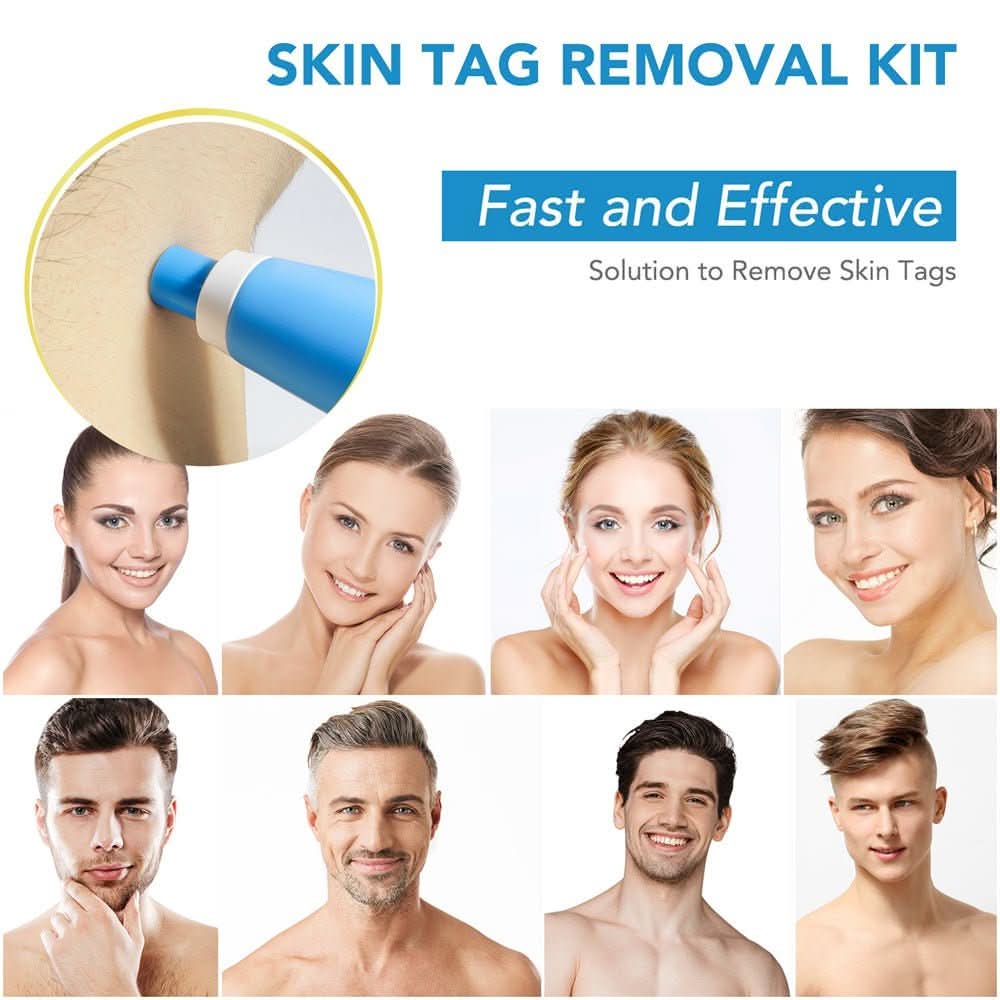 ClearSkin – Compact Precision Spot Treatment Device