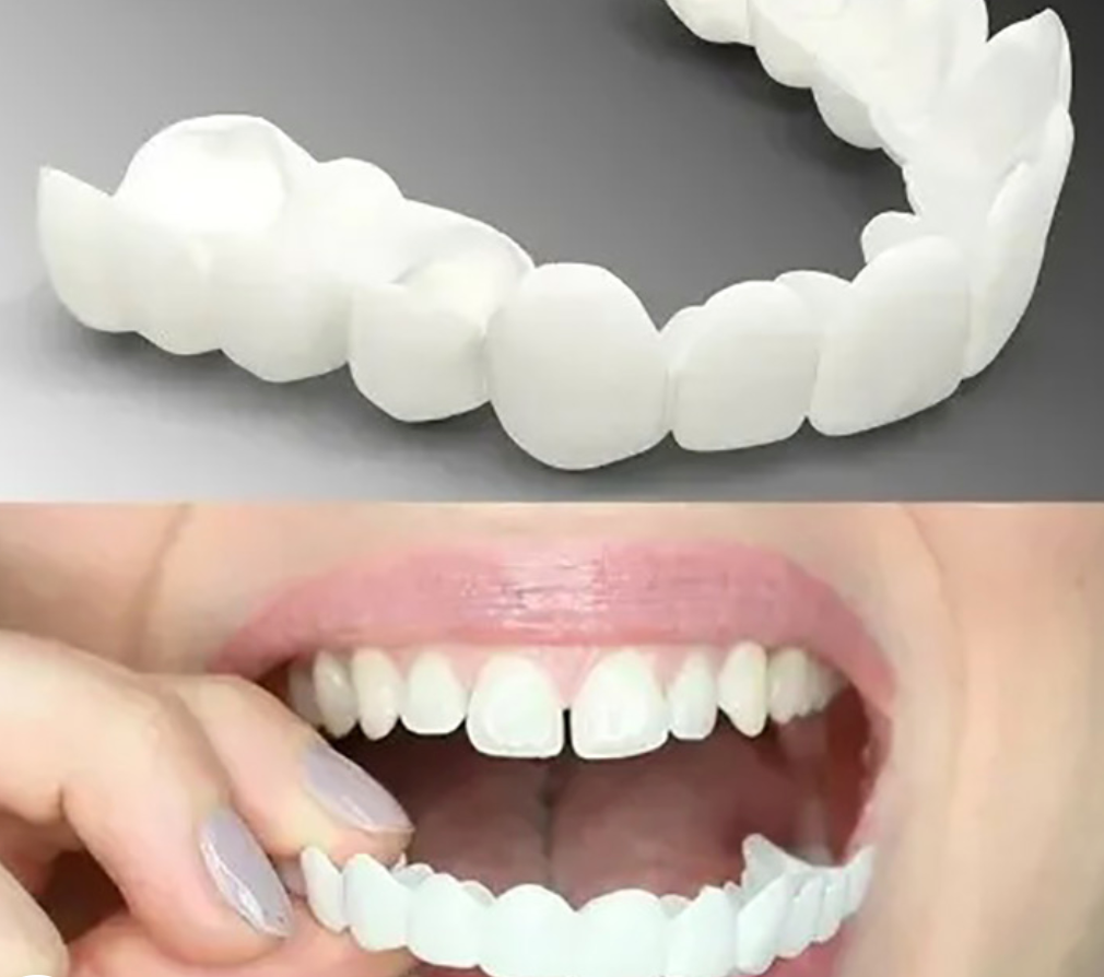 FlexiSmile Removable Cosmetic Teeth Cover – Reusable Snap-On Design
